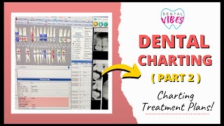 DENTAL CHARTING TX PLANS // PART 2 // Charting for Dental Assistants