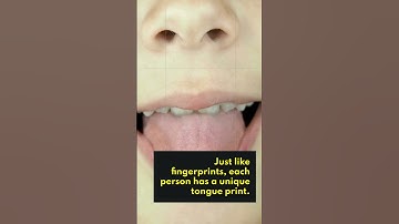 Biological Fingerprint: Your Tongue Print is Unique | #HealthFacts | #Shorts | #Viral