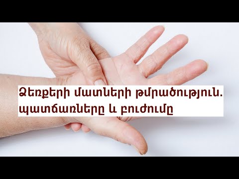 Video: Ինչպես ընդգծել ձեռքի երակները. 14 քայլ (նկարներով)