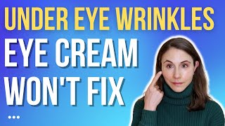 UNDER EYE WRINKLES THAT EYE CREAMS WON'T FIX 🤔 @DrDrayzday