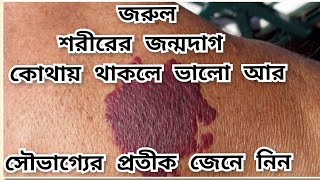 Are you lucky if you have a birthmark or mole anywhere on your body??@astrologerramshastri8362 screenshot 5