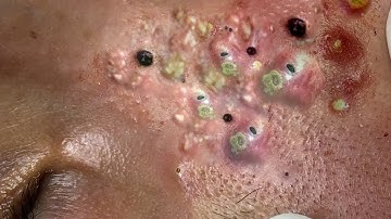 𝐂𝐡𝐢𝐥𝐥 𝐘𝐨𝐮𝐫 𝐋𝐢𝐟𝐞 𝐖𝐢𝐭𝐡 𝐋𝐍𝐆 𝐒𝐤𝐢𝐧 𝐂𝐚𝐫𝐞 # #4687