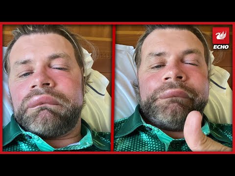 Brian McFadden Fans Concerned Over Botox Videos