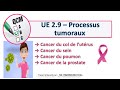 Annales franais  ue 29  processus tumoraux