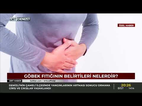 Göbek Fıtığı (Umblikal Herni) - Op. Dr. Özgür Kaya