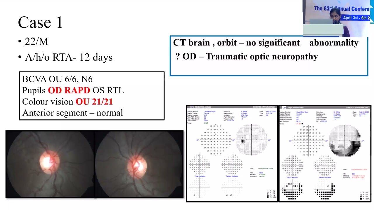 AIOS2025 IC165 T Dr  Vidhya Dharani D M How to Identify Subtle and Sub Acute, Optic Nerve Dysfunctio