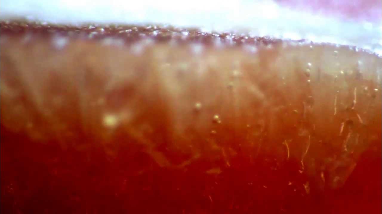 пузырьки в варенье. цистицеркоз бычий цепень. эхинококк в говяжьей печени. винный фон. токсический гепатит макропрепарат.