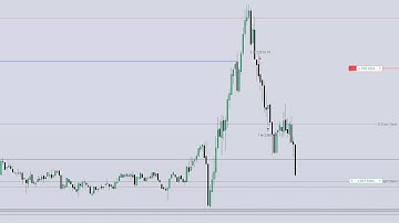 How To Trade This EASY 2025 Model! \ NQ Live Trade Walkthrough \ ICT SMART MONEY CONCEPTS