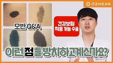 내 몸에 큰 점이 있다면... 수술 할 수 있을까? [모반 Q&A]