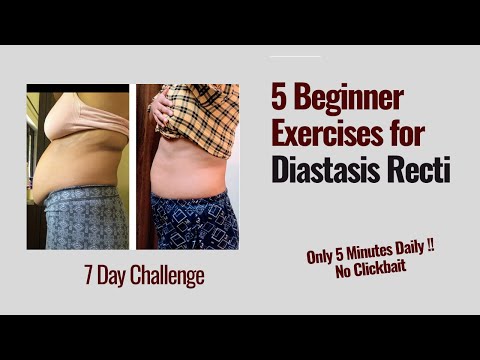 7 Effective DIASTASIS Recti Exercises after Baby in Hindi 