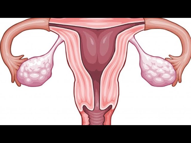 Гормональный сбой