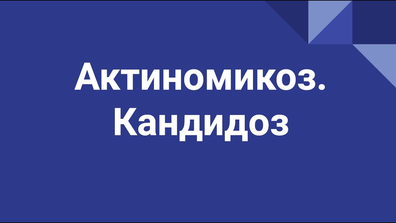 Актиномикоз, кандидоз - YouTube