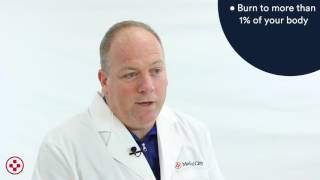 When to go to the ER for a burn