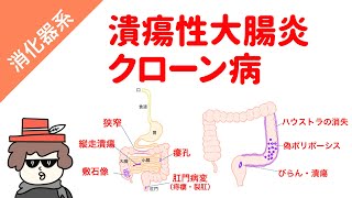 【国試対策用】潰瘍性大腸炎とクローン病