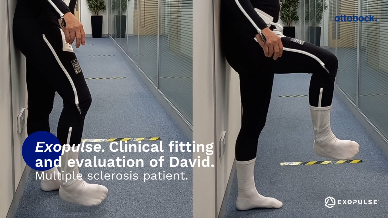 David's multiple sclerosis related spasticity before & after wearing the Exopulse Mollii Suit