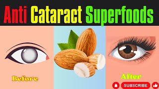 Prevent Cataract surgery!|Top 7 superfoods to slow down cataract| Top 5 eye exercises.