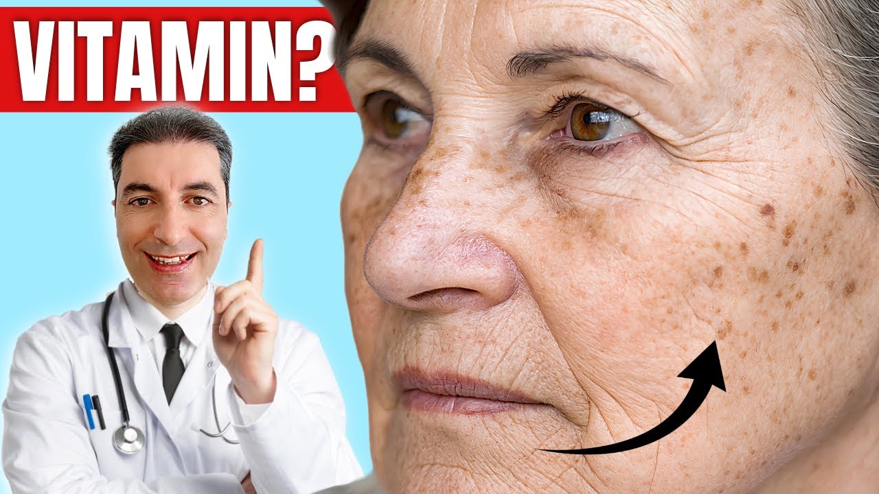Хорошо. 1 ВИТАМИН для удаления ВОЗРАСТНЫХ ПЯТЕН НА КОЖЕ!