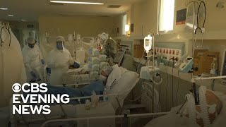 Brazil ties U.S. with largest daily number of COVID-19 cases screenshot 2