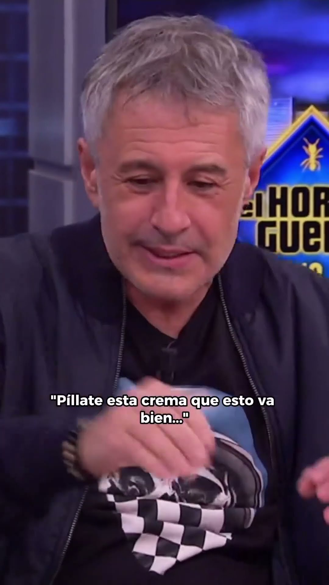 Sergio Dalma cuenta su experiencia con el botox #ElHormiguero #Shorts