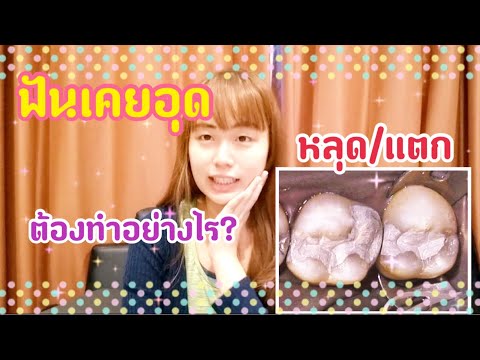 ฟันเคยอุดมาหลุด/แตกต้องทำอย่างไร?