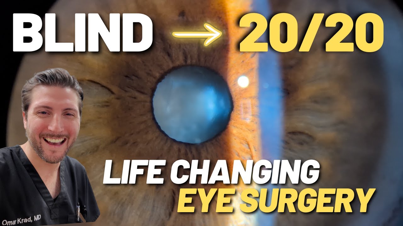 Patient Interview after Life-Changing Cataract Surgery - YouTube