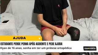 ESTUDANTE PEDE AJUDA PARA CONSEGUIR UMA PRÓTESE ORTOPÉDICA