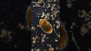 Flatworm on the Frontier! #microworlds #biology #science #microbiology #microscopy #microscope #new