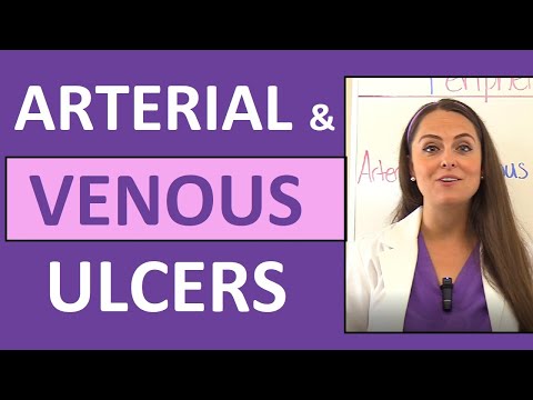 Arterial Ulcers vs. Venous Ulcers Nursing (Characteristics) for PVD (Peripheral Vascular Disease)