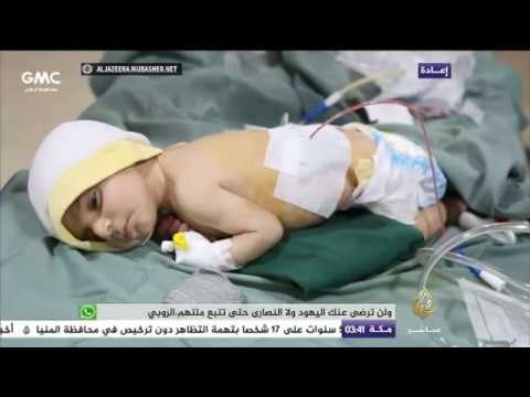 المسائية.. تواصل القصف ومعاناة النازحين في سوريا