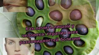 Как лечить лишай у человека: терапия всех разновидностей болезни