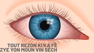 Zye Sèch Me Kijan Yon Moun Ka Fè Maladi Sa  |Sécheresse Oculaire |