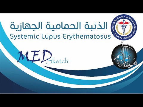 الذئبة الحمامية الجهازية_ Systemic Lupus Erythematosus _ جامعة دمشق كلية الطب البشري