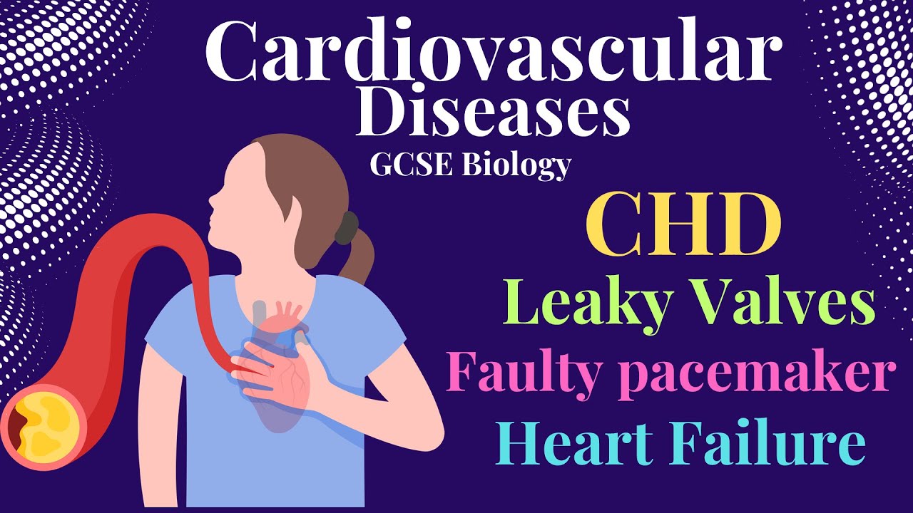CORONARY HEART DISEASE GCSE BIOLOGY COMBINED SCIENCE YouTube Coronary heart disease gcse biology combined science youtube