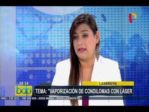 condilomas informacion
