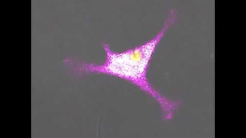 T CELL KILLING A CANCER CELL #cancer #cancertreatment