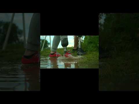 гидравлическая стопа Echelon #протез #киборг #протезирование#рек #рекомендации #протезголени#shorts