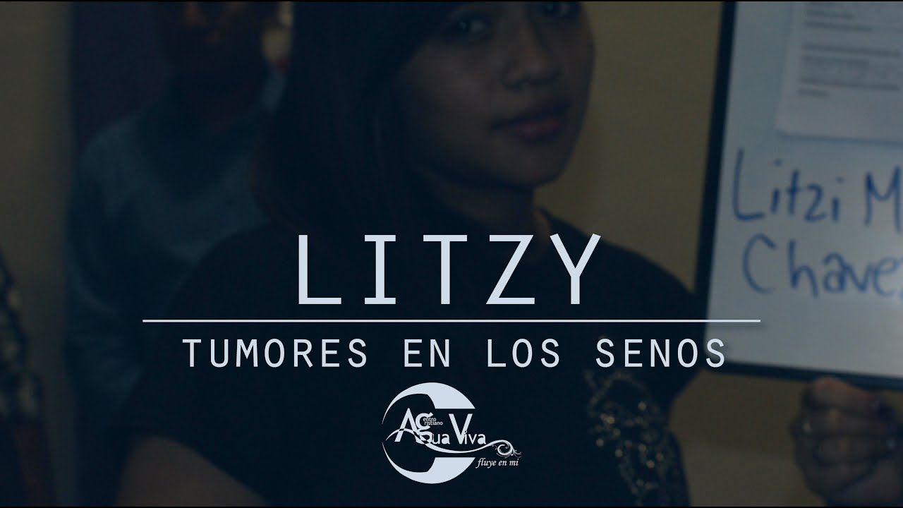 milagros caliva Litzy, tumores en los senos