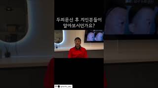 정수리 탈모 고민이라면!!그레이시티 파주강서점으로 오세요♡ #그레이시티파주 #그레이시티강서 #목동두피문신 #일산두피문신 #파주두피문신 #그레이시티#smp #마곡두피문신 #탈모