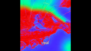 Revolutionizing Cancer Treatment: Nanobots vs Pancreatic Cancer