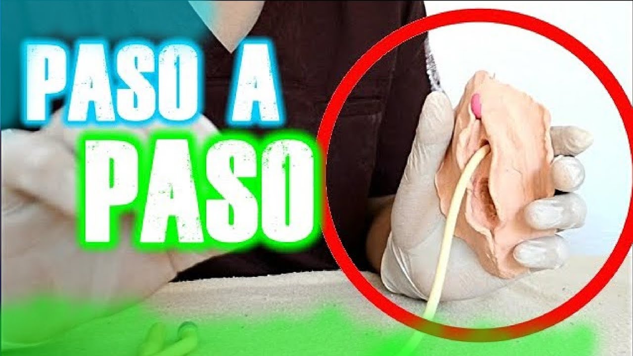 COLOCACION Y FIJACION DE SONDA VESICAL