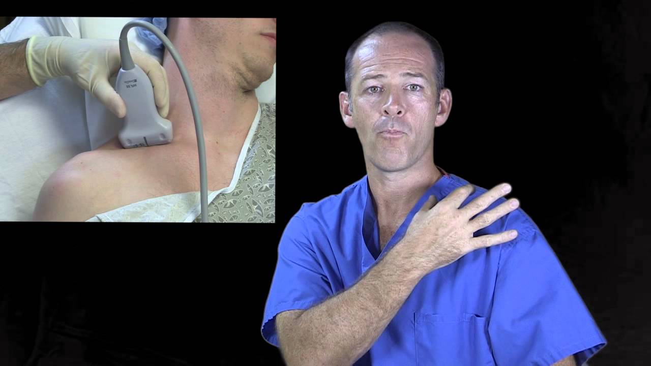 Supraclavicular Nerve Block Ultrasound Guided YouTube supraclavicular-nerve-block-ultrasound-guided-youtube