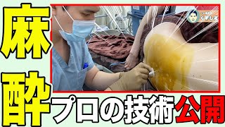 【〇〇万円麻酔】医師として失敗が許されない！究極の麻酔見せます【硬膜外麻酔】