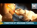 Ponction et drainage pleural