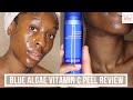 Algenist blue algae vitamin c dark spot correcting peel first impressions  byalicexo