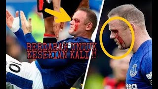 10 Kecelakaan Paling Mengerikan Sepakbola yang terjadi di Tahun 2017