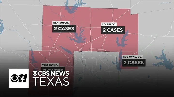 8 measles cases confirmed in North Texas; health officials to address outbreak