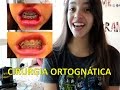 Cirurgia Ortognática : Manual de Sobrevivência (Débora Aladim)