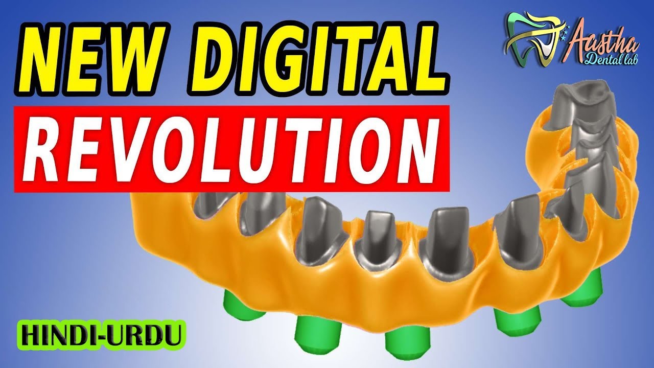 Exocad Implant Screw retained All on 4 Tutorial -HINDI AND URDU