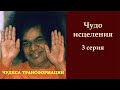 Чудеса трансформации | Сатья Саи Баба | Чудо исцеления | 3 серия