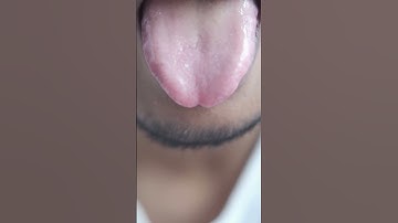 The next generation of biometric identification: Tongue print